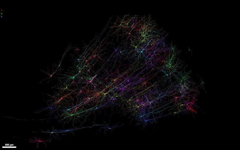 Snapshot of human neurons