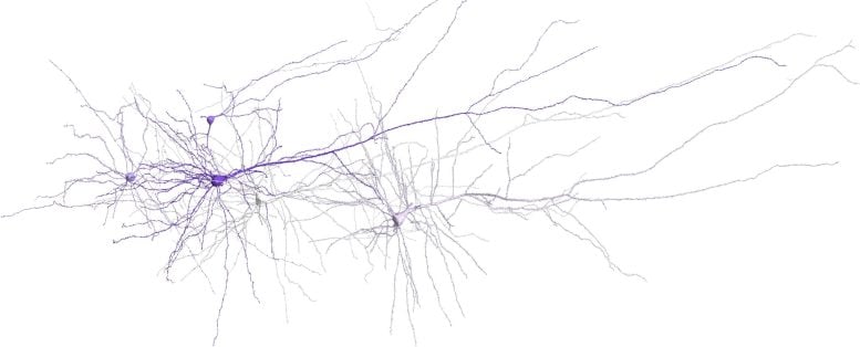 3D reconstruction of human cortex neurons