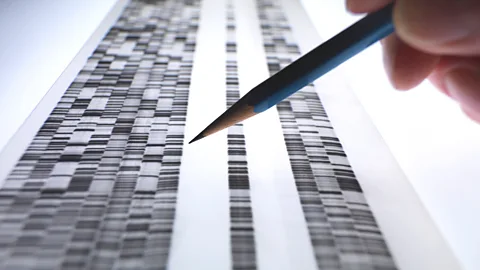 Getty Images A scientist looking at a DNA gel (Credit: Getty Images)