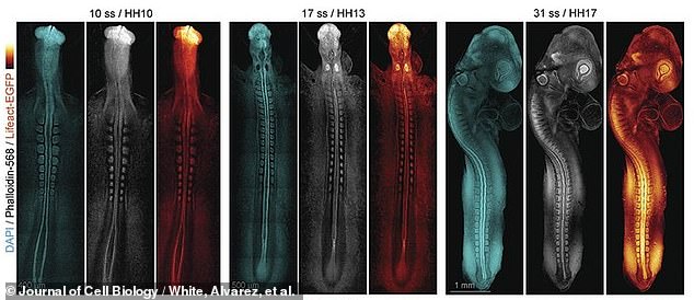 Above, later photographs of the early spinal and brain formation of the embryo