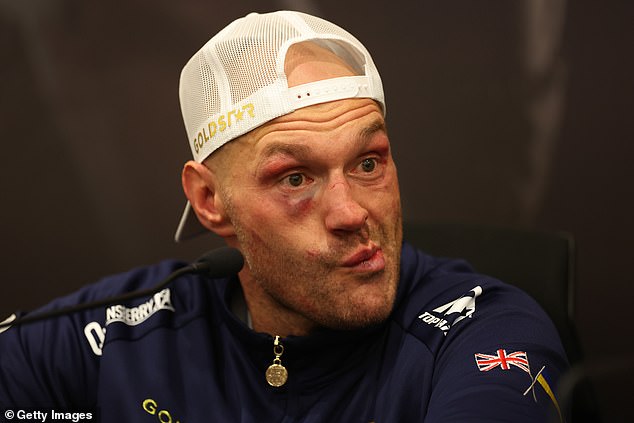 Sympathy for Tyson Fury is in short supply after his defeat to Oleksandr Usyk